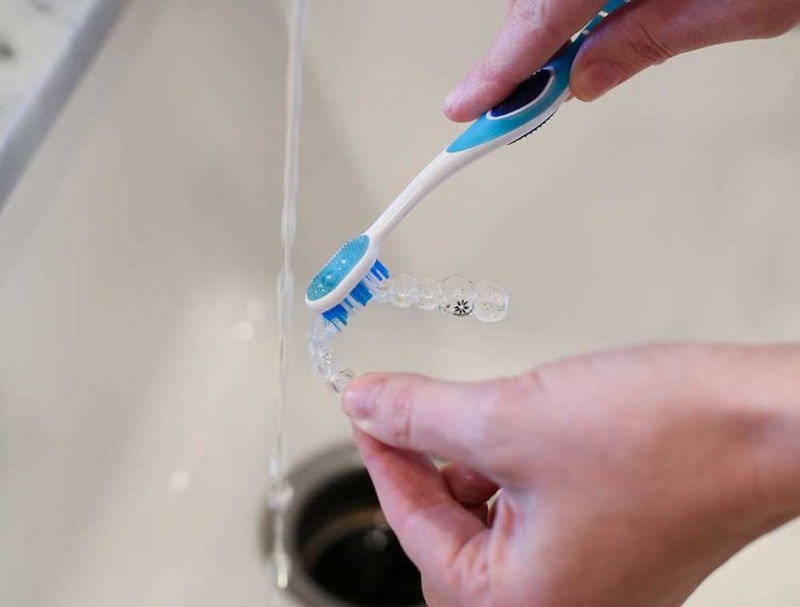 Thắc mắc: Niềng răng trong suốt có đau không? 3