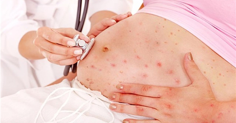 Thắc mắc thường gặp: Giá tiêm vacxin trước khi mang thai, nên tiêm lẻ hay tiêm theo gói? 1