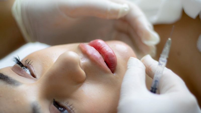 Thắc mắc: Tiêm filler mũi bị tràn có nguy hiểm không?1