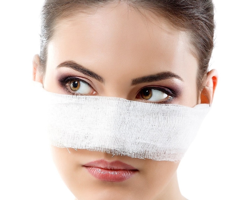 Thắc mắc: Tiêm filler mũi bị tràn có nguy hiểm không?3