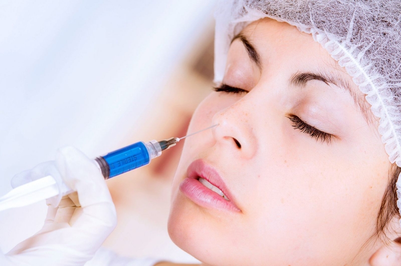 Thắc mắc: Tiêm filler mũi bị tràn có nguy hiểm không?4