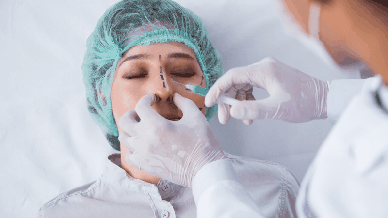 Thắc mắc: Tiêm filler mũi có tự tan được không?3