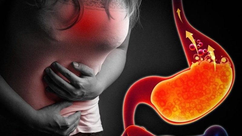 Thắc mắc: Trào ngược dạ dày ăn bơ được không? 7