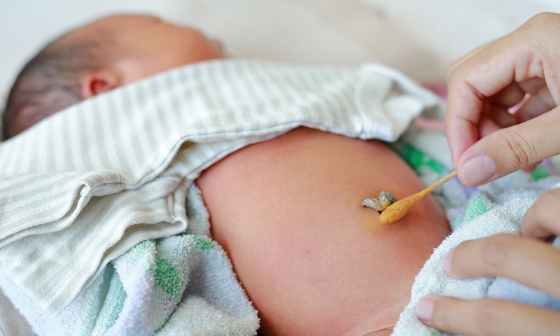 Thắc mắc: Trẻ sơ sinh mấy ngày rụng rốn?3