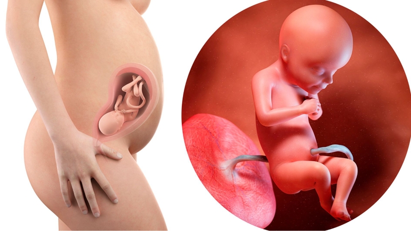 Xét nghiệm NIPT có hiệu quả cao hơn trong việc sàng lọc các hội chứng di truyền