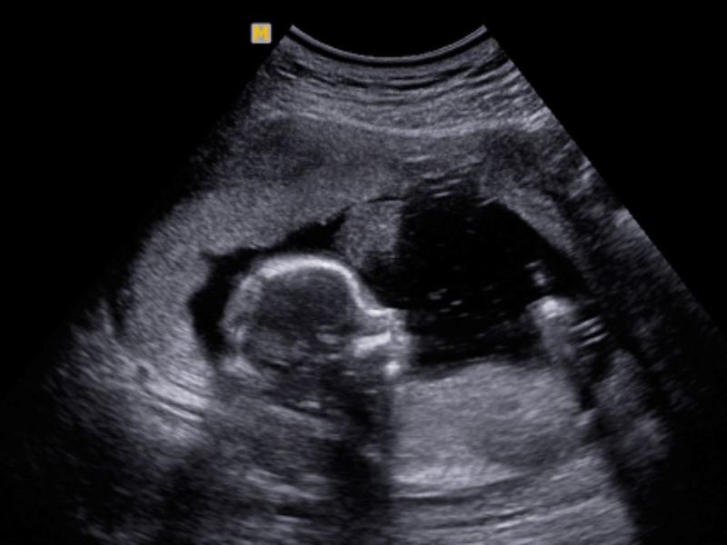 Thai 16 tuần phát triển như thế nào và những lưu ý cho mẹ bầu 1