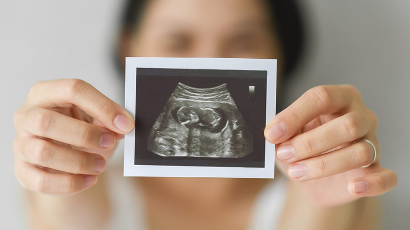 Thai 17 tuần là mấy tháng? Kích thước phát triển và những điều cần lưu ý 4