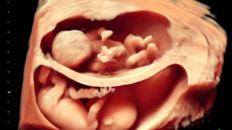 Thai 30 tuần nặng 1,7kg: Sự phát triển thai nhi và những điều mẹ bầu cần biết 1