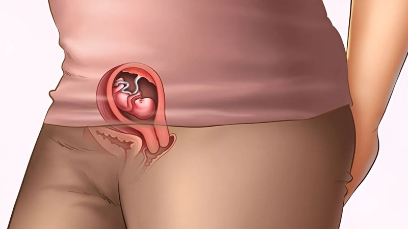 Thai IVF 10 tuần phát triển thế nào? Có nguy cơ gì cần theo dõi 2