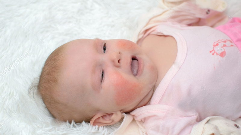 Thải độc gan cho bé định kỳ: Nên hay không nên? 3