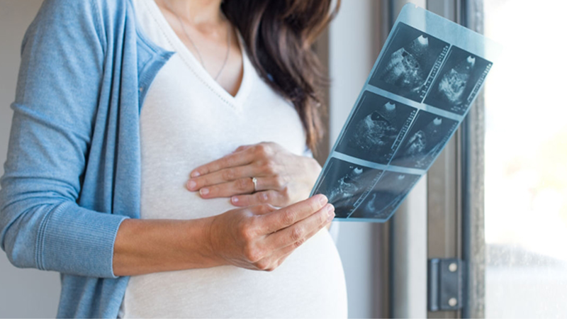 Thai giới hạn tăng trưởng (FGR) là gì? 1