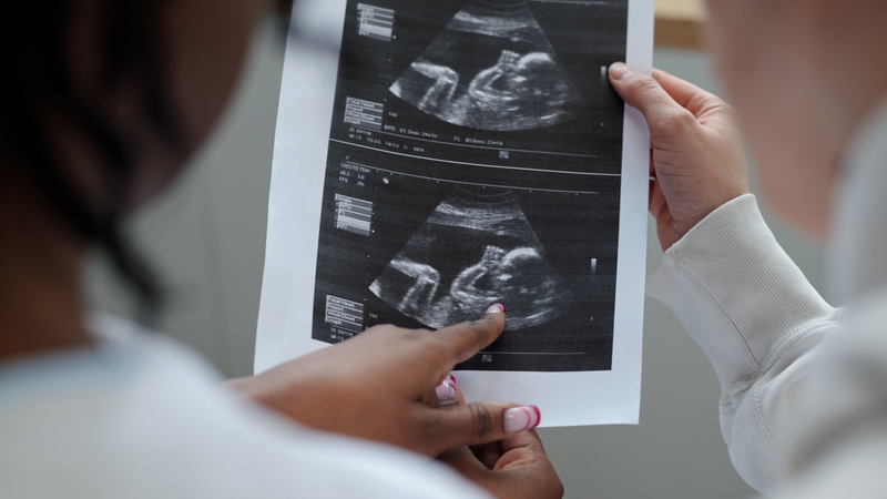 Siêu âm phát hiện một khối bất thường trong ổ bụng