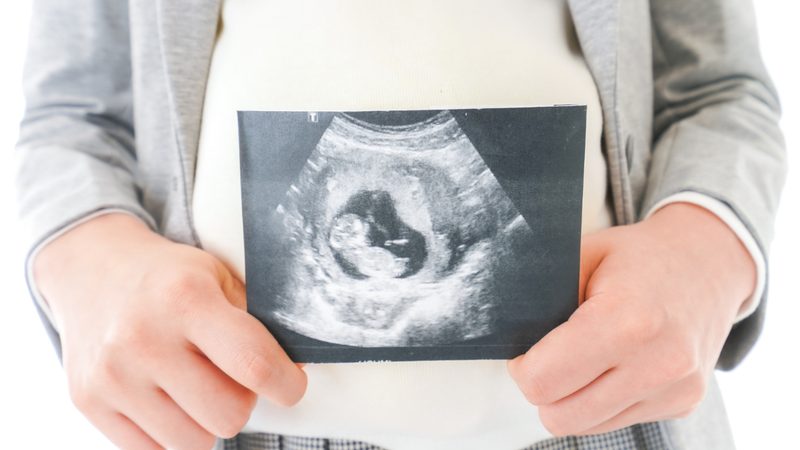 Thai nhi hóa đá sẽ dần bị vôi hóa, tạo thành một khối “thai hóa đá”