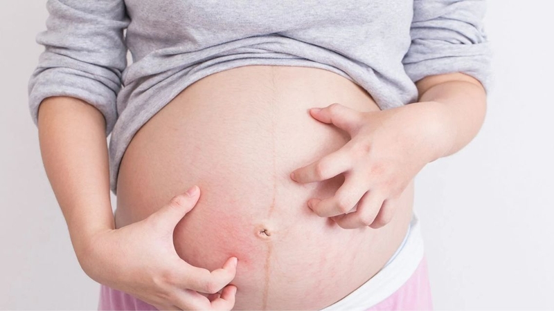 Thai nhi mọc tóc gây ngứa bụng chỉ là kinh nghiệm dân gian truyền miệng