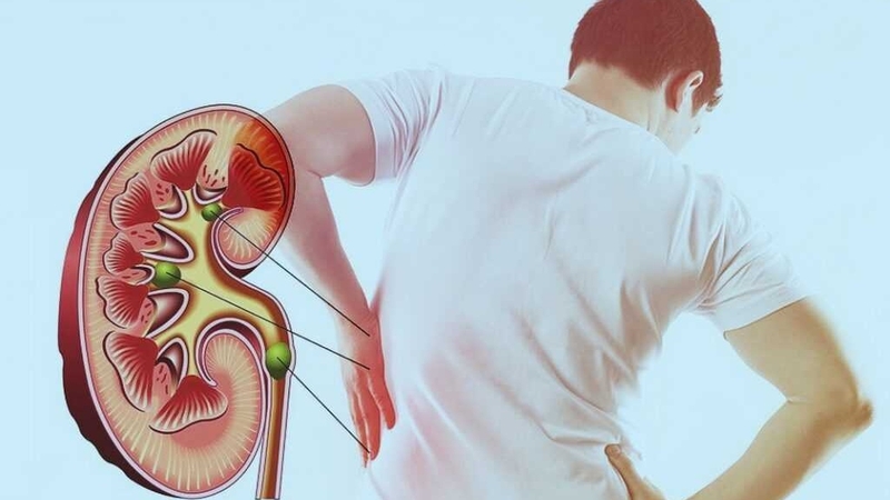 Thận yếu uống gì? Các loại thức uống và thực phẩm tốt cho thận 1