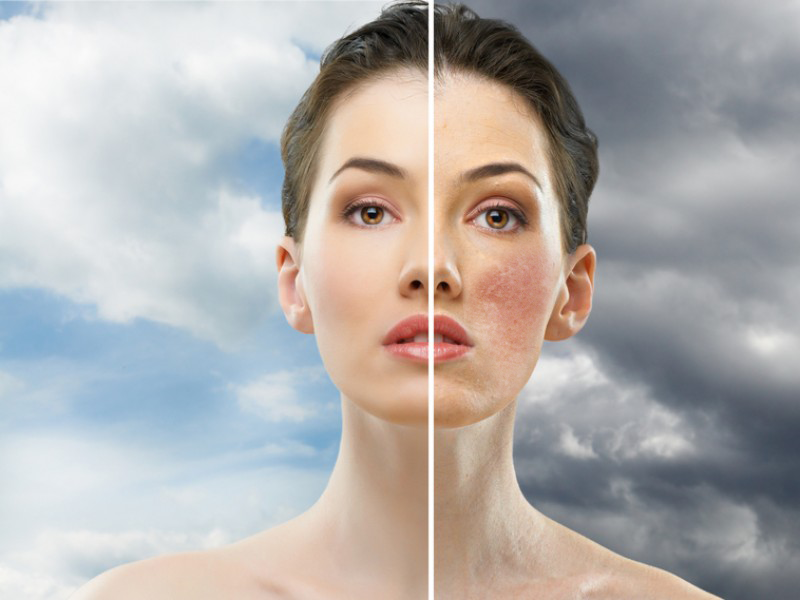 Thành phần và công dụng của xịt khoáng Vichy là gì 4