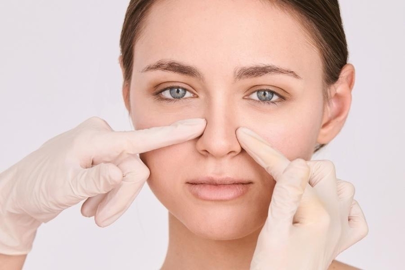 thao-sun-mui-sau-nang-mui-co-nguy-hiem-khong 1.jpg