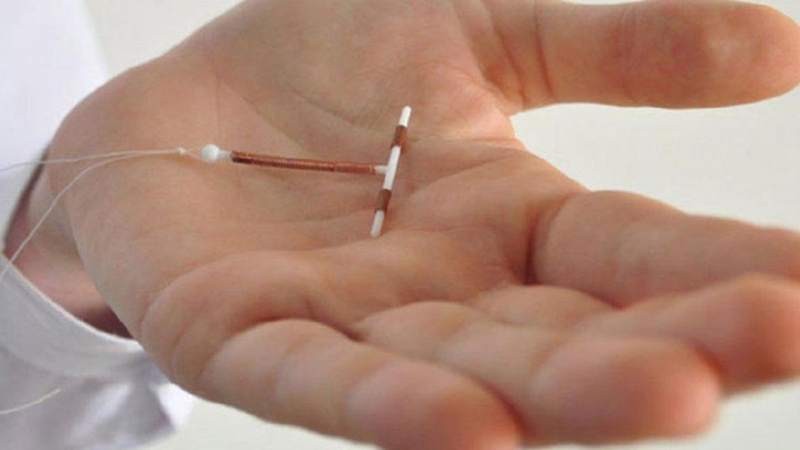Tháo vòng tránh thai bao lâu thì đặt lại được? 2