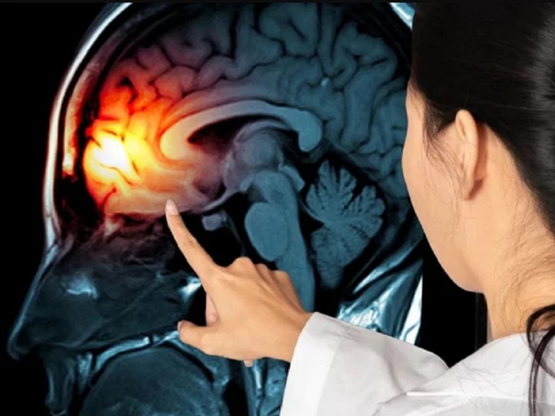 that-dung-la-gi-nguyen-nhan-va-bieu-hien-cua-that-dung 1.jpg