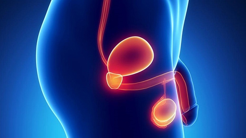 Thắt ống dẫn tinh có tháo được không? 4