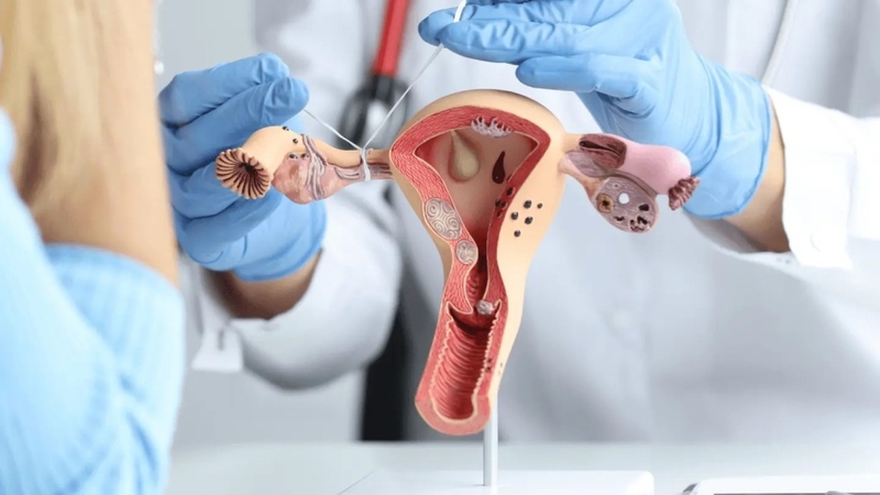 Thắt ống dẫn trứng có đau không? Một số rủi ro thường gặp 3