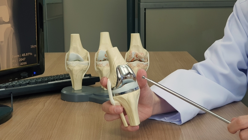 Thay khớp gối nhân tạo là gì?