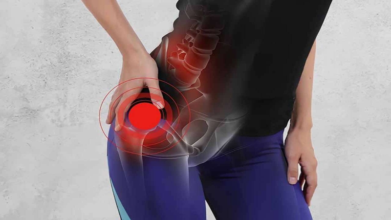 Thay khớp háng là gì? Những thông tin cần biết về thay khớp háng 2