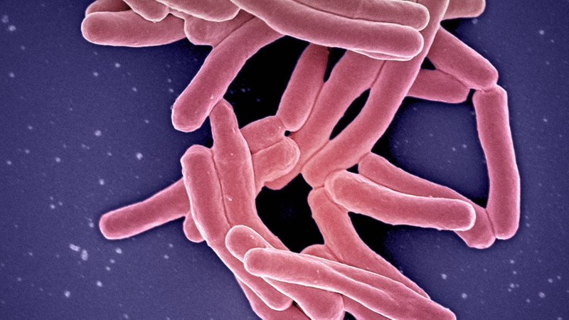 Một số vi khuẩn tiết độc tố gây tổn thương toàn thân như vi khuẩn gây lao phổi