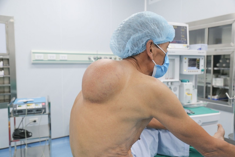 Thế nào là khối u lành tính? Các phương pháp chẩn đoán và điều trị hiện nay 2