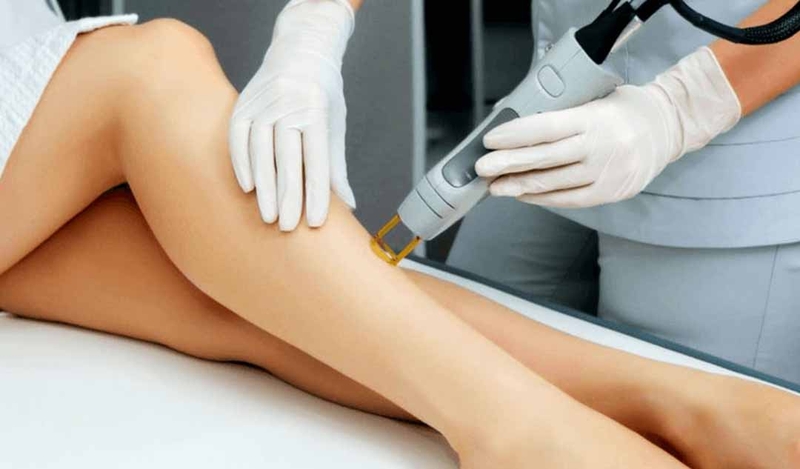 Thế nào là tẩy lông vĩnh viễn, có nên thực hiện không?