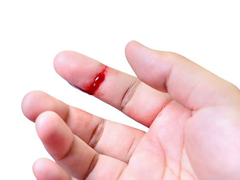 the-tich-khoi-hong-cau-giam-nguyen-nhan-va-cach-dieu-tri 1