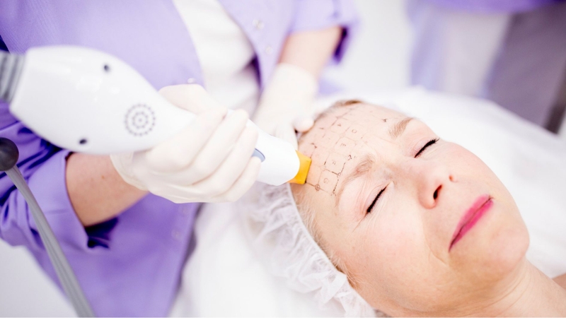 Thermage FLX giá bao nhiêu? Chi phí thay đổi tùy theo nhiều yếu tố