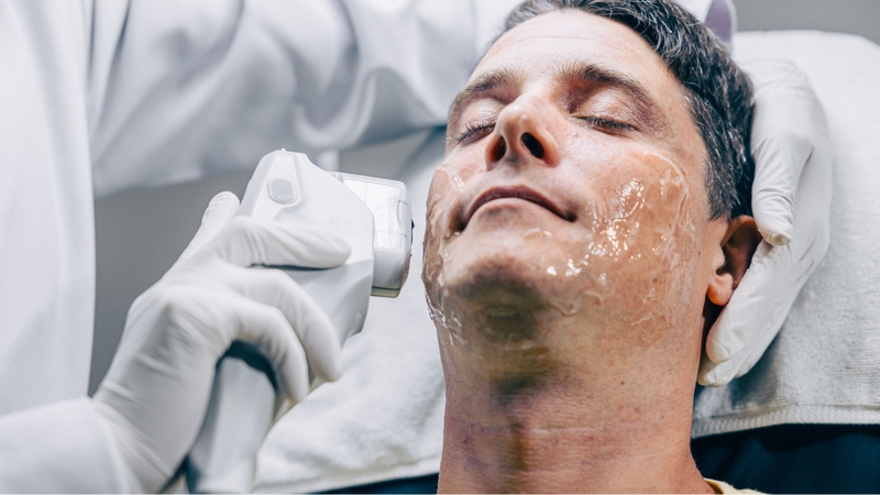 Diện tích vùng da điều trị càng rộng thì chi phí Thermage FLX càng cao