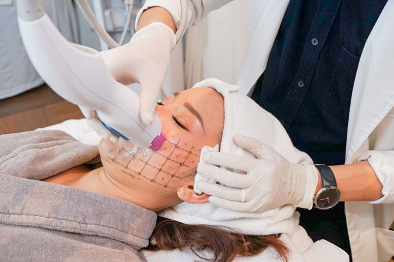 Thermage flx là gì? Một số công dụng và hạn chế của thermage flx mà bạn nên biết 1