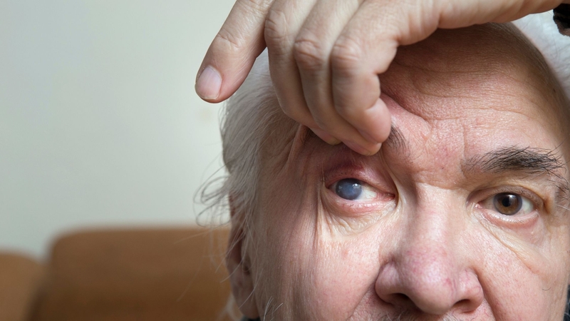 Thị lực là gì? Những nguyên nhân thường gặp gây giảm thị lực 4