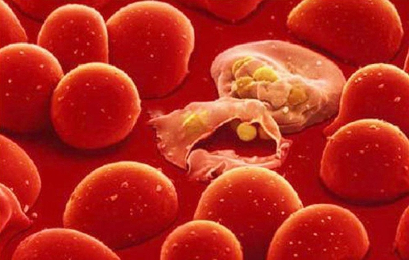 thieu-enzyme-g6-pd-o-tre-dau-hieu-nhan-biet-chan-doan-va-cach-cham-soc 1.jpg