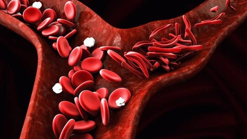 Thiếu hồng cầu có nguy hiểm không? 1