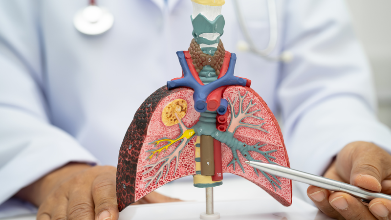 Alpha-1 antitrypsin là một protein đóng vai trò như một lá chắn bảo vệ, đặc biệt là cho phổi