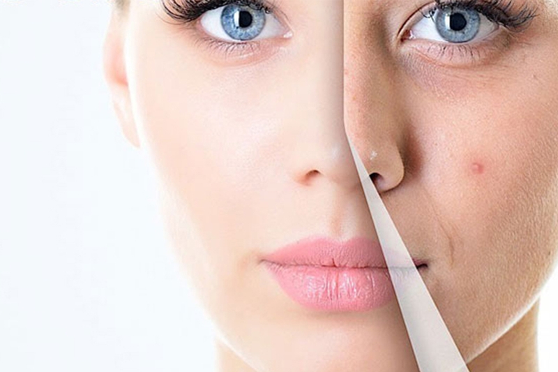 Thiếu hụt vitamin D sẽ ảnh hưởng thế nào đến làn da? 2