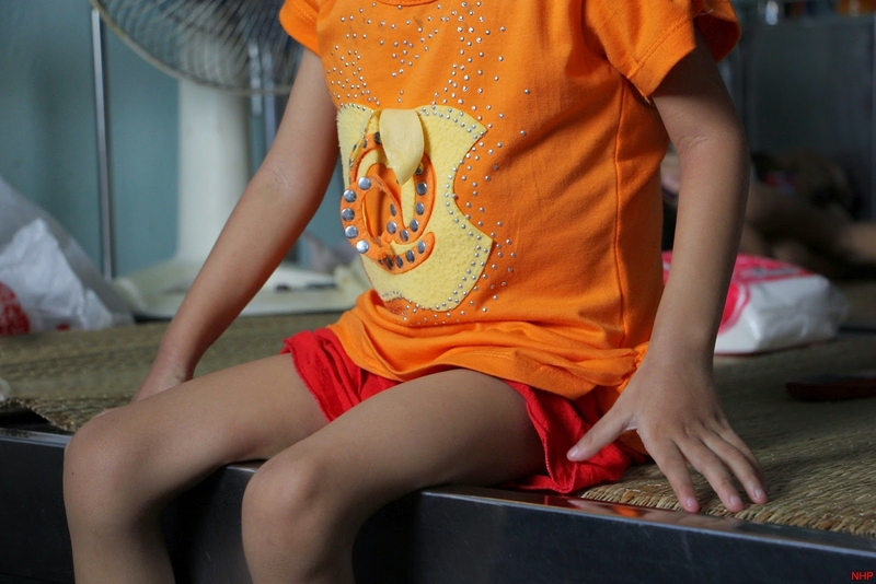 Bạn biết gì về bệnh thiếu máu hồng cầu nhỏ nhược sắc 3