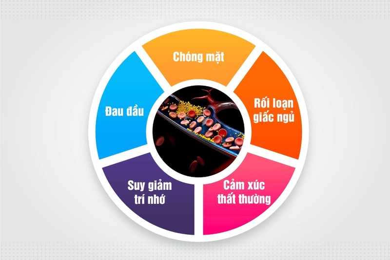 Chữa thiểu năng tuần hoàn não bằng Đông Y: Giải pháp hiệu quả và cân nhắc 1