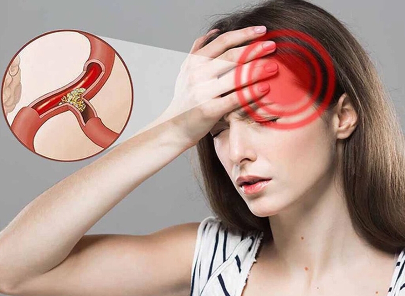 Thiếu máu não uống vitamin gì? Bật mí một số thức uống tốt cho người thiếu máu não 1