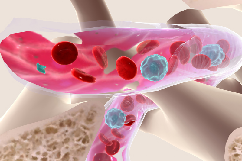 Thiếu máu nhưng không thiếu sắt​ và 3 nguyên nhân thường gặp 1