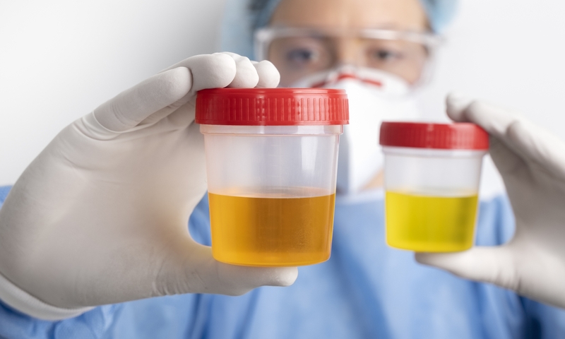 Thiếu men G6PD là bệnh gì? Trẻ thiếu men G6PD không nên ăn gì? 2