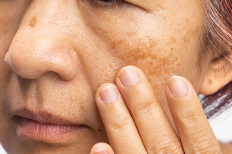 Thiếu vitamin có các dấu hiệu nào? Nguyên nhân và cách phòng ngừa 3