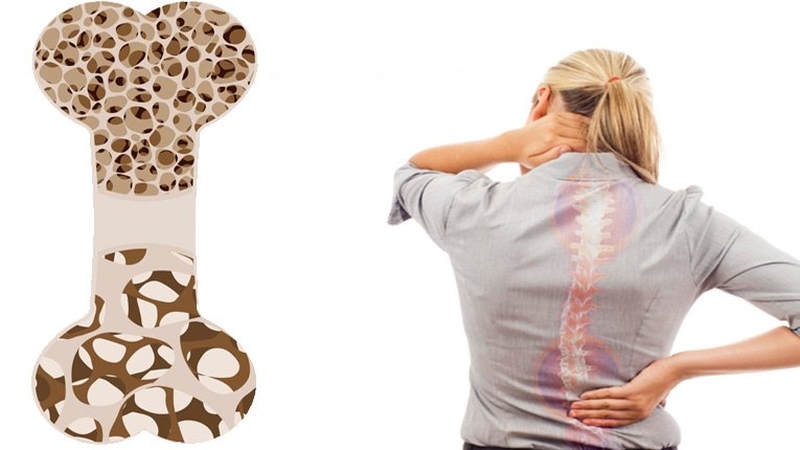 Thiếu vitamin K gây bệnh gì? Vì sao cơ thể thiếu vitamin K 3