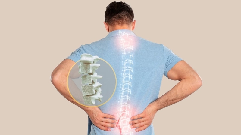 Thiếu xương là bệnh gì? Nguyên nhân và cách khắc phục 5