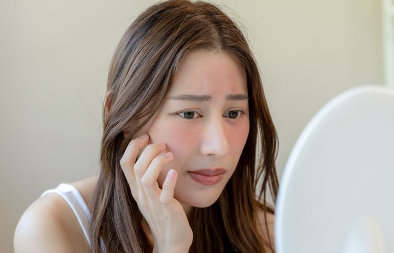 Thoa serum bị nóng mặt có sao không? Cần làm gì để khắc phục 2