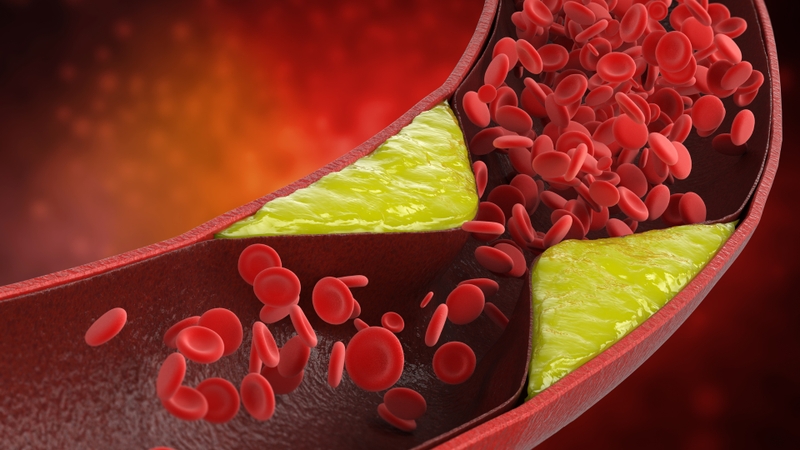 Thoái hóa chất trắng: Nguyên nhân, triệu chứng, phương pháp điều trị 5