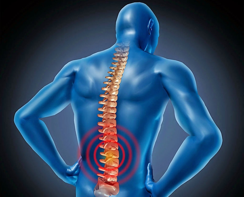 Thoái hóa cột sống m47 là gì và điều trị bệnh như thế nào?